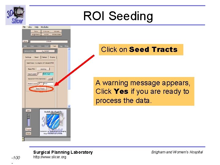 ROI Seeding Click on Seed Tracts A warning message appears, Click Yes if you