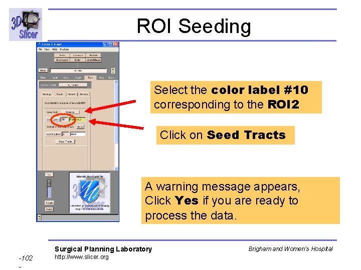ROI Seeding Select the color label #10 corresponding to the ROI 2 Click on