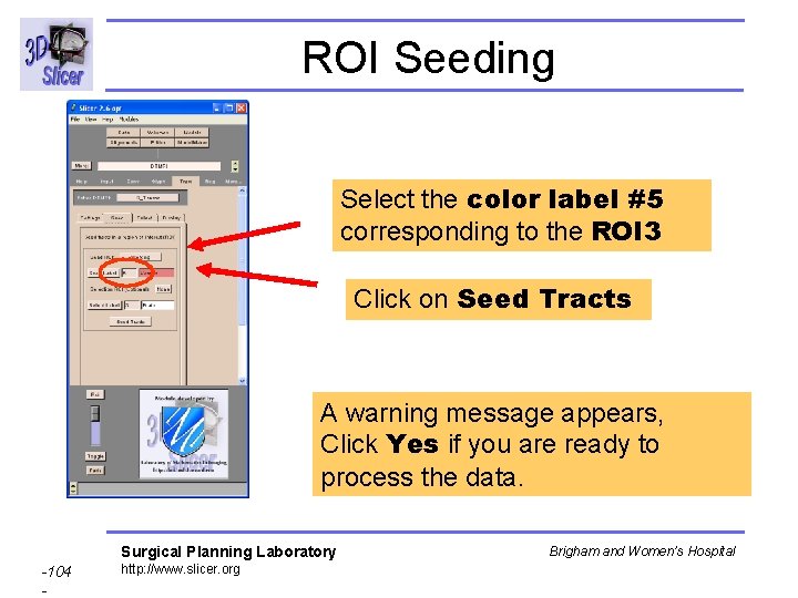 ROI Seeding Select the color label #5 corresponding to the ROI 3 Click on