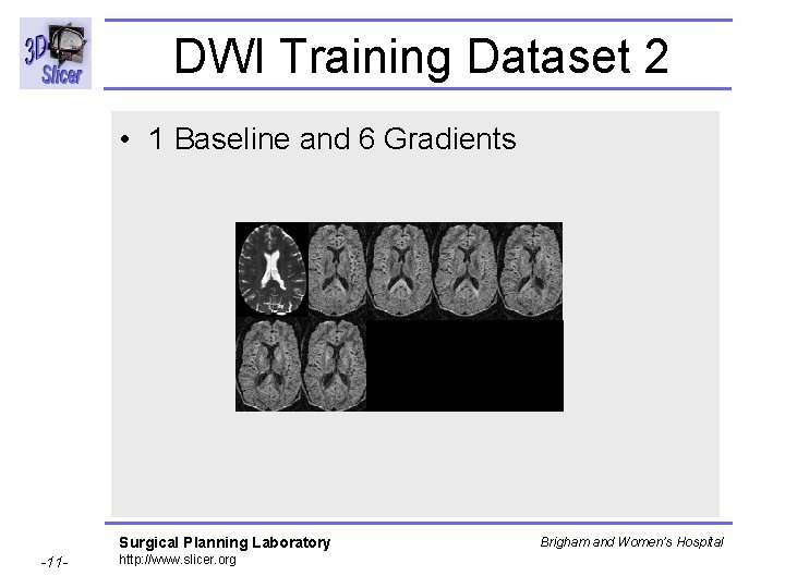 DWI Training Dataset 2 • 1 Baseline and 6 Gradients Surgical Planning Laboratory -11