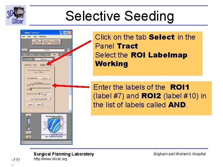 Selective Seeding Click on the tab Select in the Panel Tract Select the ROI