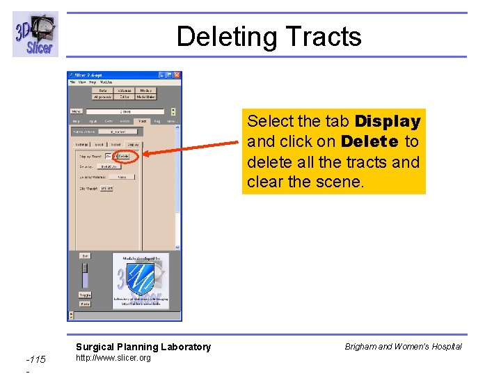 Deleting Tracts Select the tab Display and click on Delete to delete all the