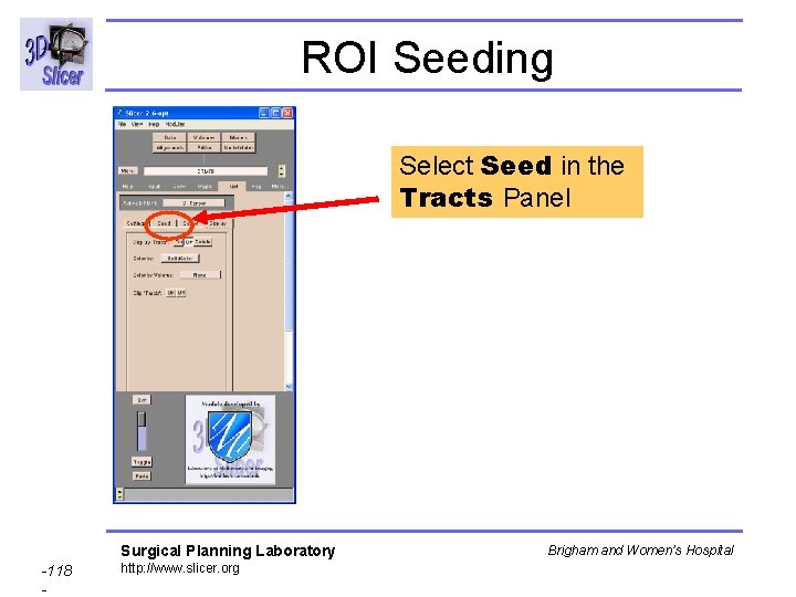 ROI Seeding Select Seed in the Tracts Panel Surgical Planning Laboratory -118 - http:
