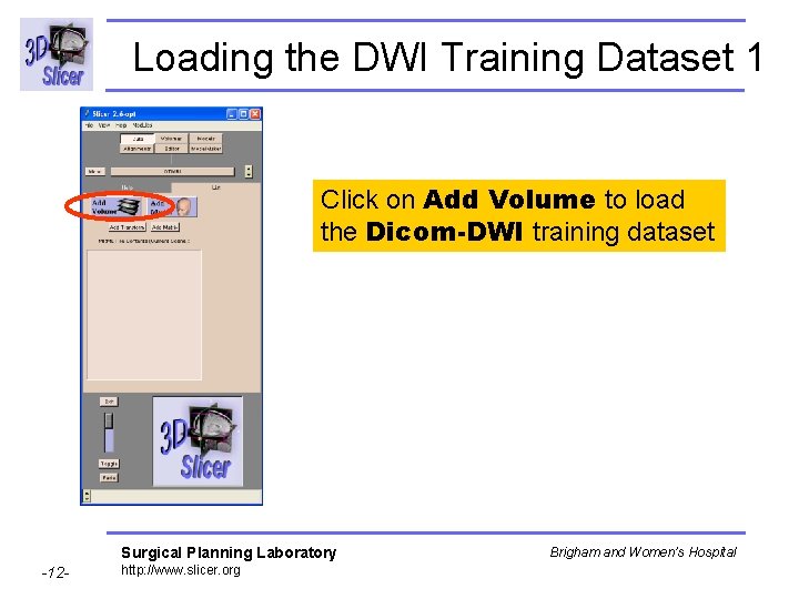 Loading the DWI Training Dataset 1 Click on Add Volume to load the Dicom-DWI