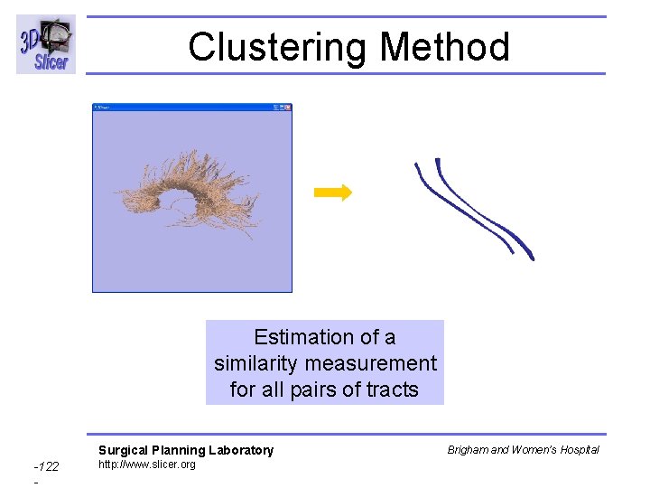 Clustering Method Estimation of a similarity measurement for all pairs of tracts Surgical Planning