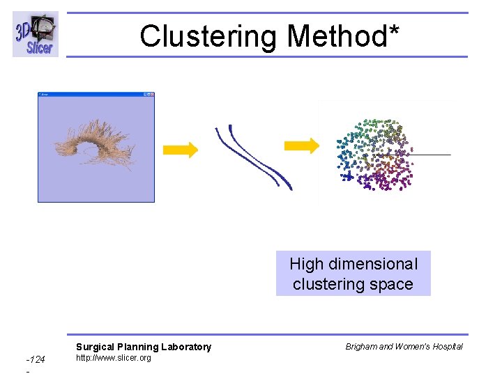 Clustering Method* High dimensional clustering space Surgical Planning Laboratory -124 - http: //www. slicer.