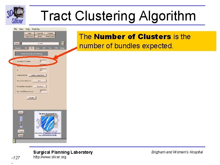Tract Clustering Algorithm The Number of Clusters is the number of bundles expected. Surgical