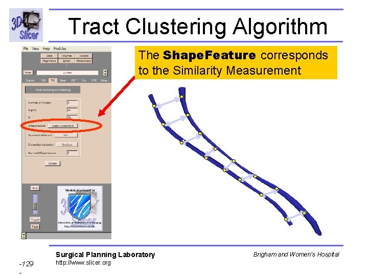 Tract Clustering Algorithm The Shape. Feature corresponds to the Similarity Measurement Surgical Planning Laboratory