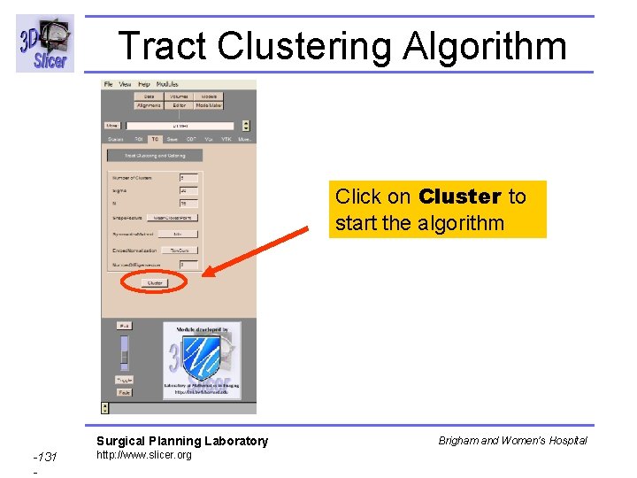 Tract Clustering Algorithm Click on Cluster to start the algorithm Surgical Planning Laboratory -131