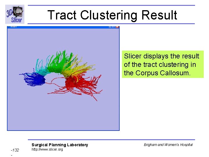 Tract Clustering Result Slicer displays the result of the tract clustering in the Corpus