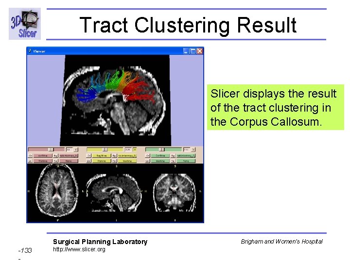 Tract Clustering Result Slicer displays the result of the tract clustering in the Corpus