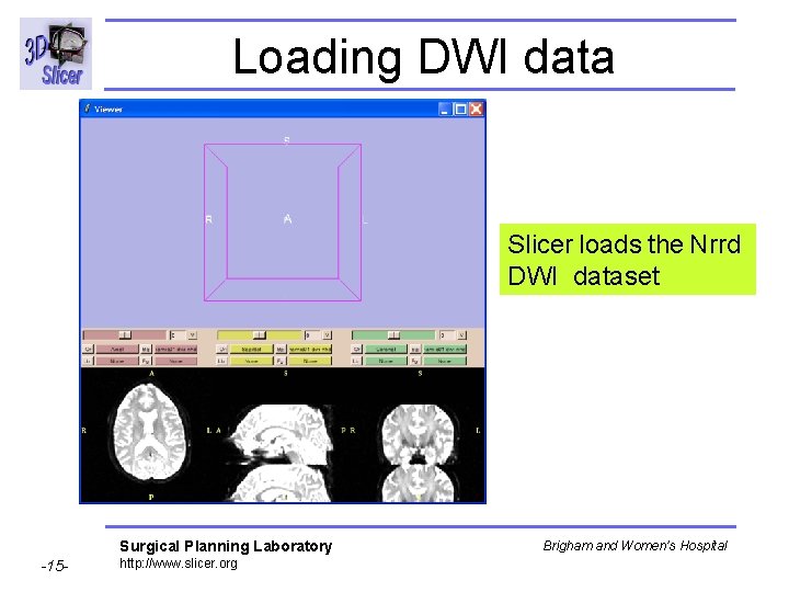 Loading DWI data Slicer loads the Nrrd DWI dataset Surgical Planning Laboratory -15 -