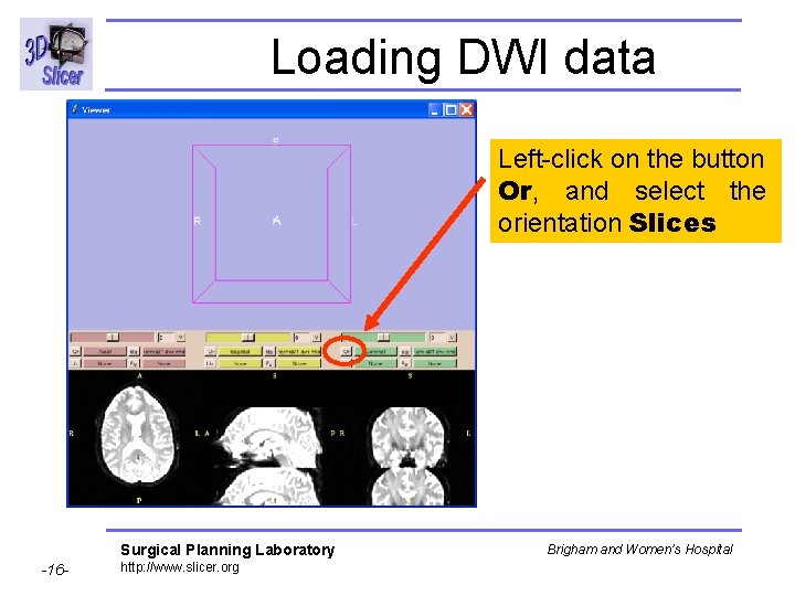 Loading DWI data Left-click on the button Or, and select the orientation Slices Surgical