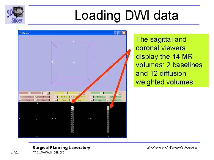 Loading DWI data The sagittal and coronal viewers display the 14 MR volumes: 2