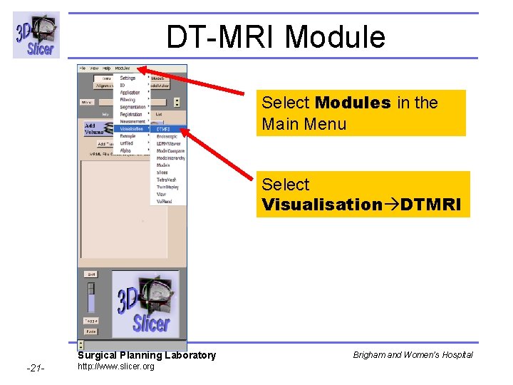 DT-MRI Module Select Modules in the Main Menu Select Visualisation DTMRI Surgical Planning Laboratory