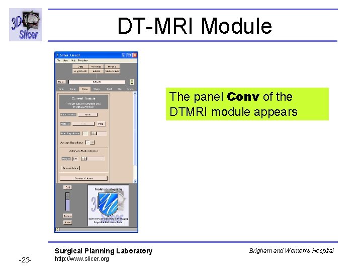 DT-MRI Module The panel Conv of the DTMRI module appears Surgical Planning Laboratory -23