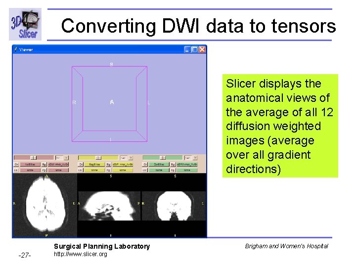 Converting DWI data to tensors Slicer displays the anatomical views of the average of