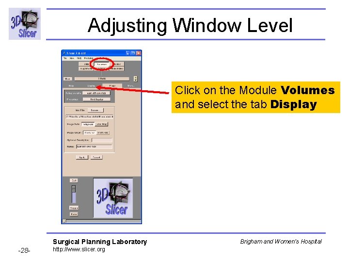 Adjusting Window Level Click on the Module Volumes and select the tab Display Surgical