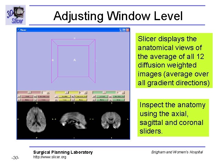 Adjusting Window Level Slicer displays the anatomical views of the average of all 12