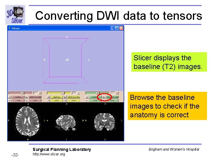 Converting DWI data to tensors Slicer displays the baseline (T 2) images. Browse the
