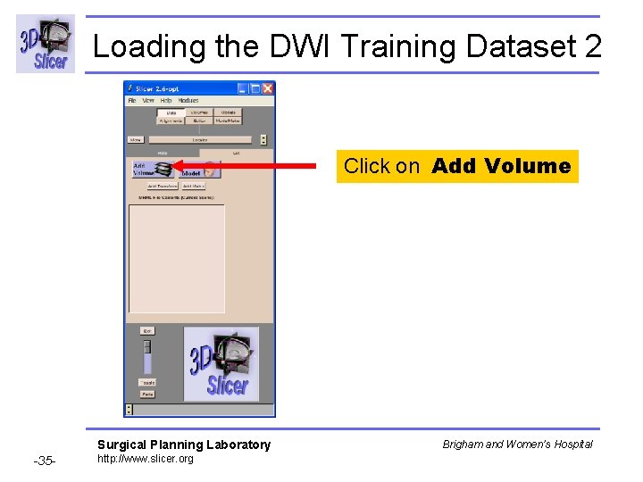 Loading the DWI Training Dataset 2 Click on Add Volume Surgical Planning Laboratory -35