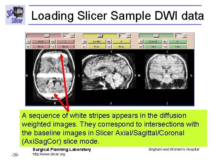 Loading Slicer Sample DWI data A sequence of white stripes appears in the diffusion
