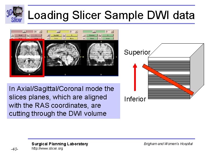 Loading Slicer Sample DWI data Superior In Axial/Sagittal/Coronal mode the slices planes, which are