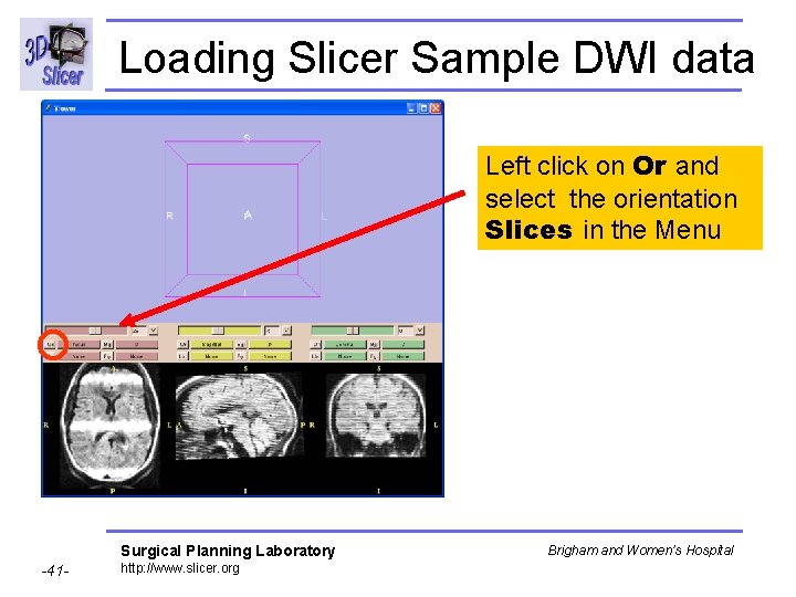 Loading Slicer Sample DWI data Left click on Or and select the orientation Slices