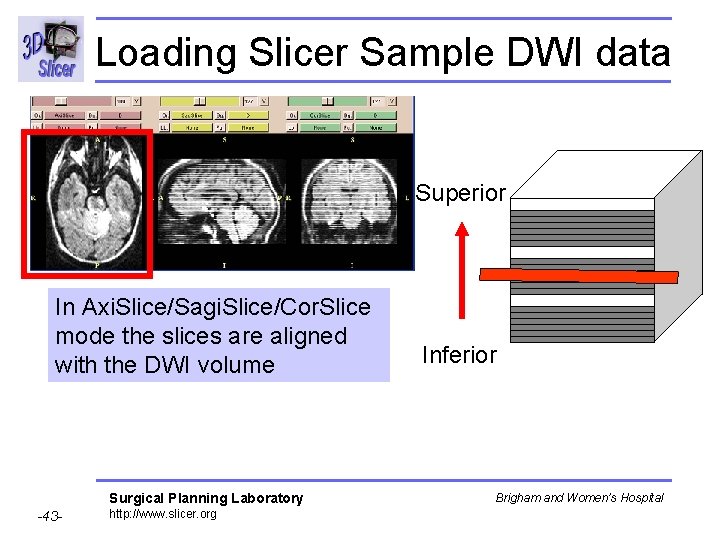 Loading Slicer Sample DWI data Superior In Axi. Slice/Sagi. Slice/Cor. Slice mode the slices