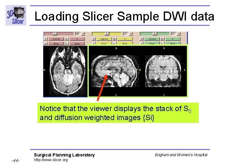 Loading Slicer Sample DWI data Notice that the viewer displays the stack of S