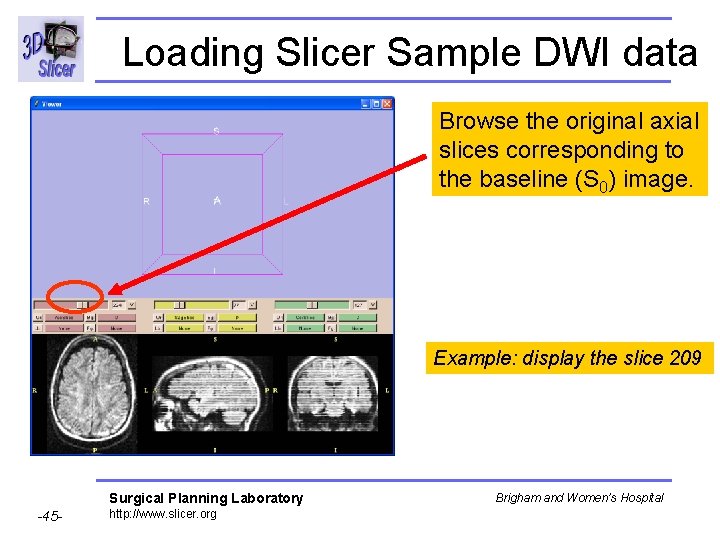 Loading Slicer Sample DWI data Browse the original axial slices corresponding to the baseline