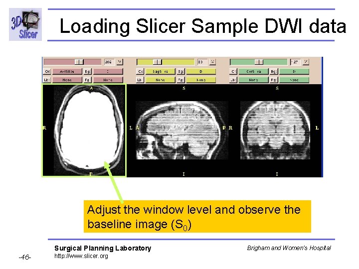 Loading Slicer Sample DWI data Adjust the window level and observe the baseline image
