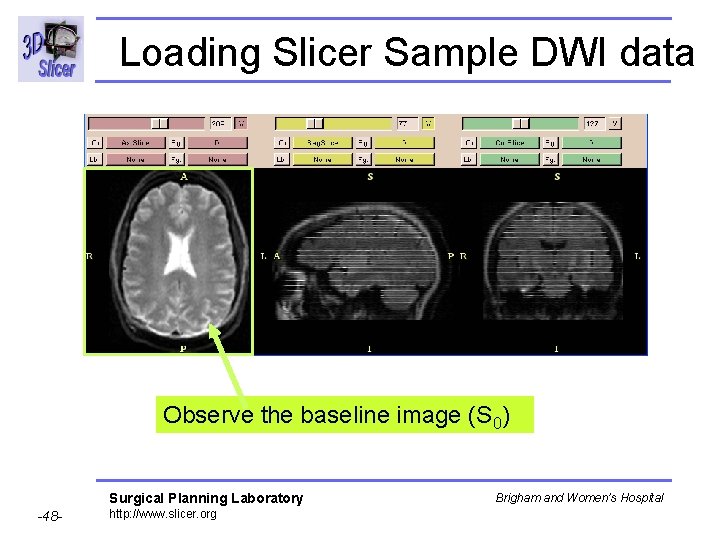Loading Slicer Sample DWI data Observe the baseline image (S 0) Surgical Planning Laboratory