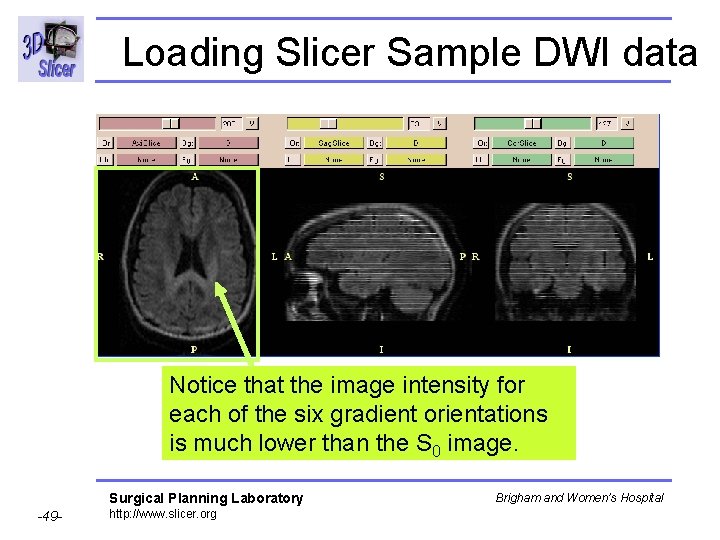 Loading Slicer Sample DWI data Notice that the image intensity for each of the