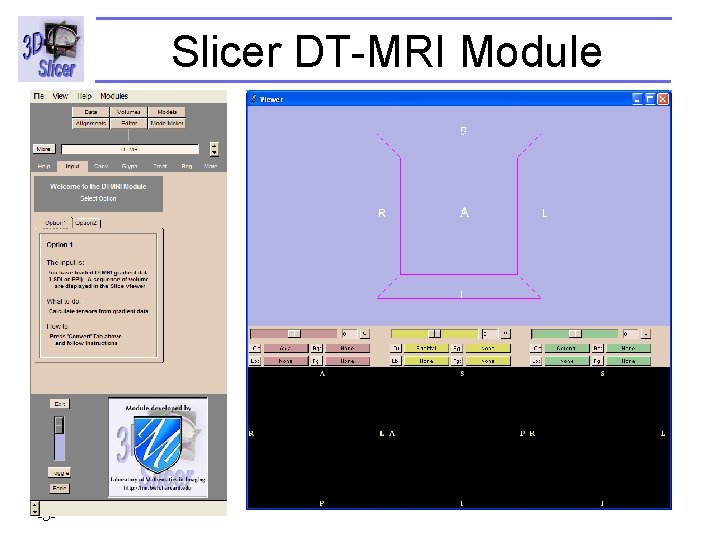 Slicer DT-MRI Module Surgical Planning Laboratory -5 - http: //www. slicer. org Brigham and