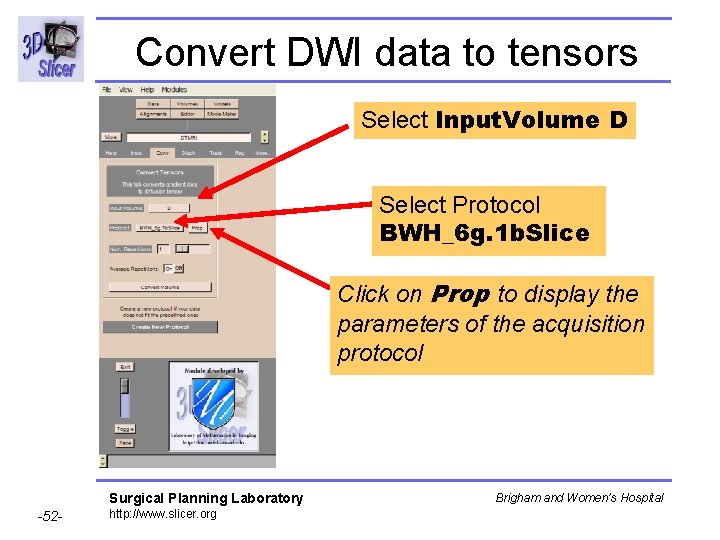 Convert DWI data to tensors Select Input. Volume D Select Protocol BWH_6 g. 1