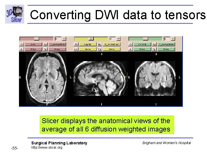 Converting DWI data to tensors Slicer displays the anatomical views of the average of