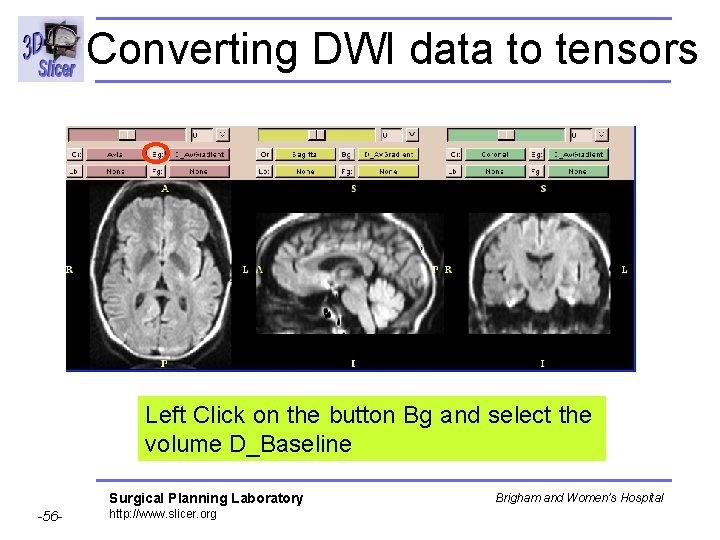 Converting DWI data to tensors Left Click on the button Bg and select the