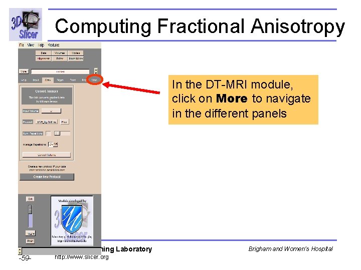 Computing Fractional Anisotropy In the DT-MRI module, click on More to navigate in the