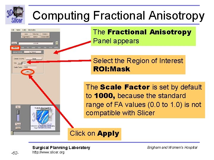 Computing Fractional Anisotropy The Fractional Anisotropy Panel appears Select the Region of Interest ROI: