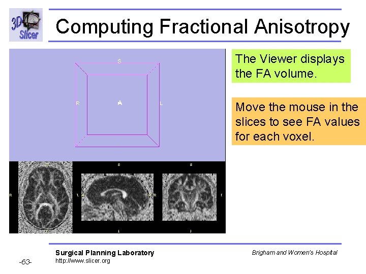 Computing Fractional Anisotropy The Viewer displays the FA volume. Move the mouse in the