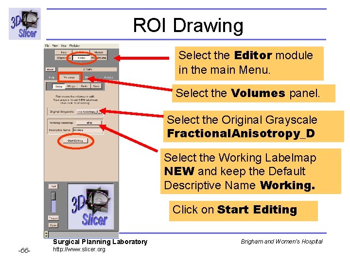 ROI Drawing Select the Editor module in the main Menu. Select the Volumes panel.