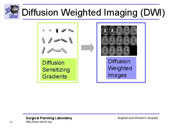 Diffusion Weighted Imaging (DWI) Diffusion Sensitizing Gradients Surgical Planning Laboratory -7 - http: //www.
