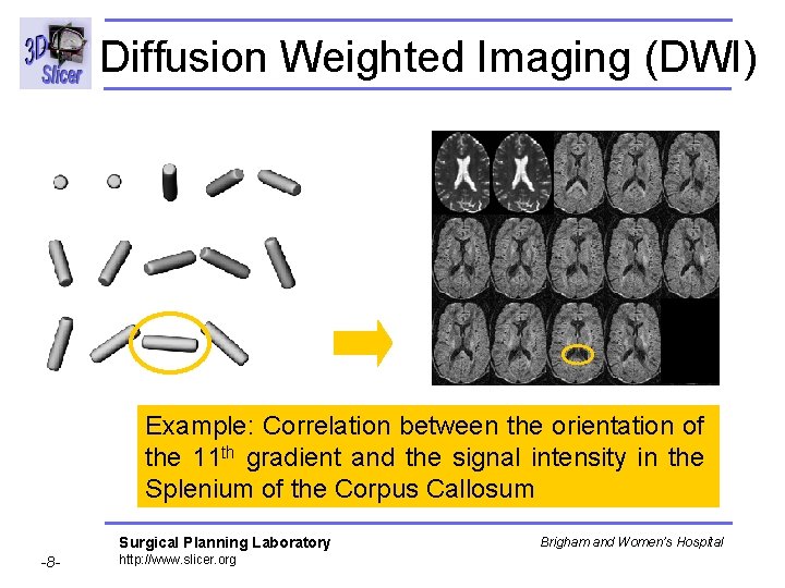 Diffusion Weighted Imaging (DWI) Example: Correlation between the orientation of the 11 th gradient