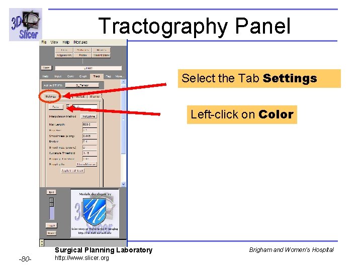 Tractography Panel Select the Tab Settings Left-click on Color Surgical Planning Laboratory -80 -