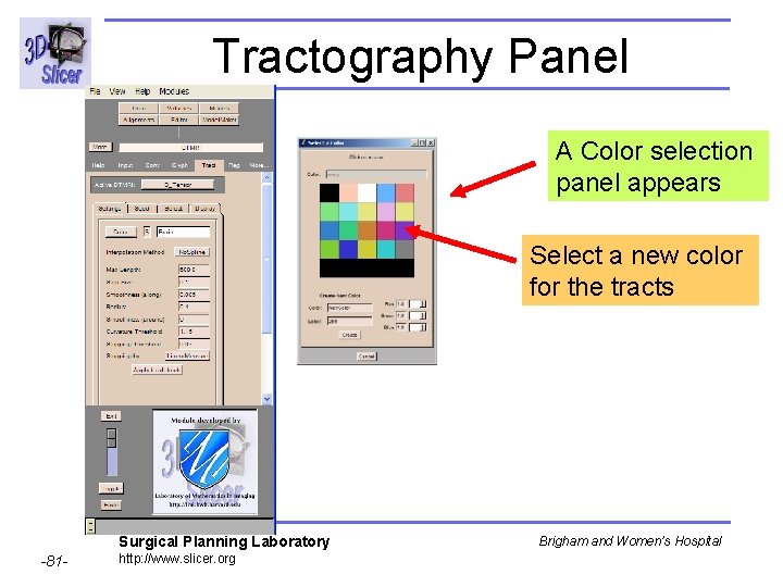 Tractography Panel A Color selection panel appears Select a new color for the tracts
