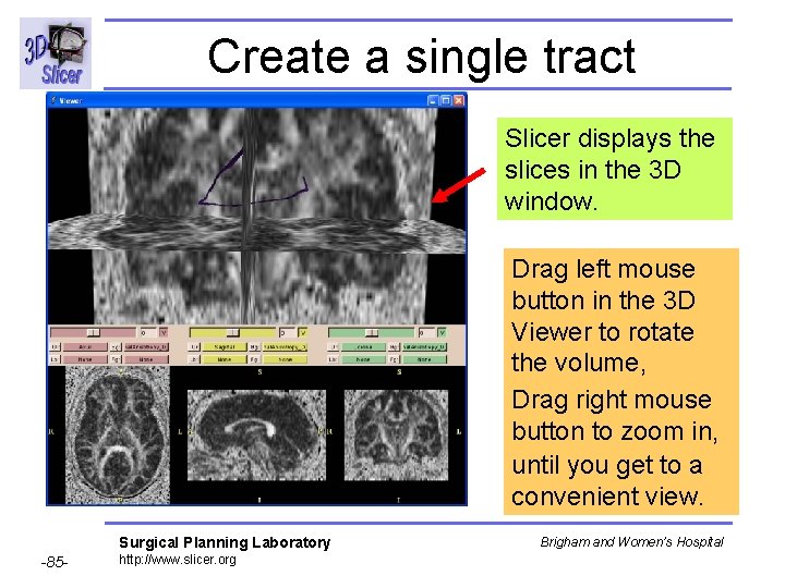 Create a single tract Slicer displays the slices in the 3 D window. Drag