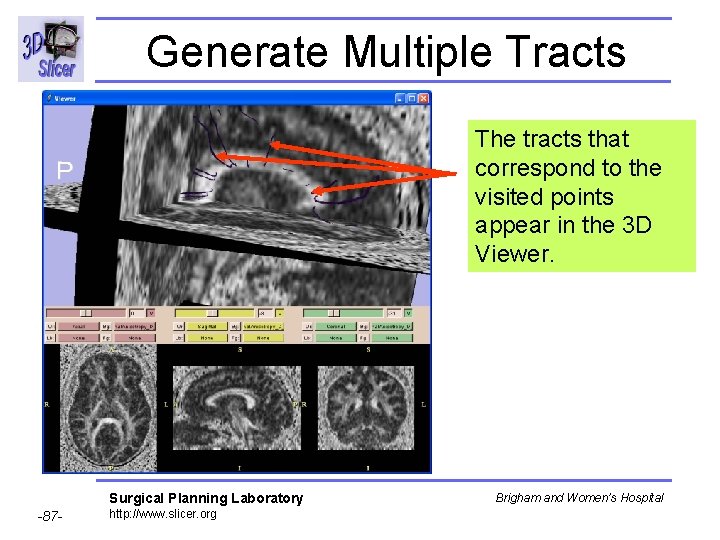 Generate Multiple Tracts The tracts that correspond to the visited points appear in the