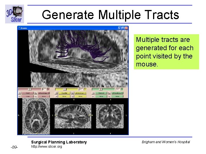 Generate Multiple Tracts Multiple tracts are generated for each point visited by the mouse.