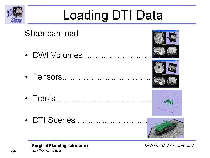 Loading DTI Data Slicer can load • DWI Volumes …………. • Tensors……………… • Tracts………………